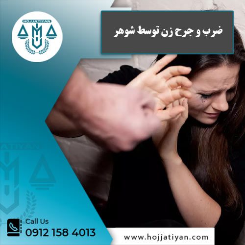 ضرب و جرح زن توسط شوهر - وکیل حجتیان